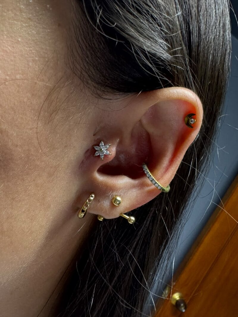 Resultado de perforación — tragus y conch